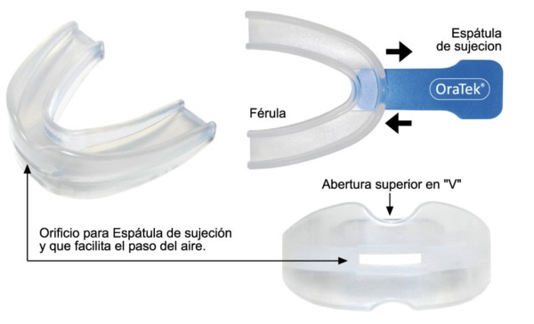 Férula anti ronquidos en Madrid, Dental Denche
